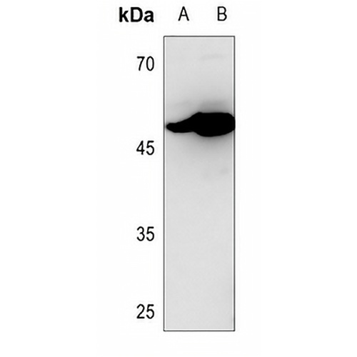 CD116 Rabbit Polyclonal Antibody