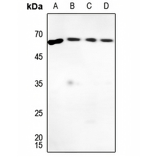 G-CSF Rabbit Polyclonal Antibody