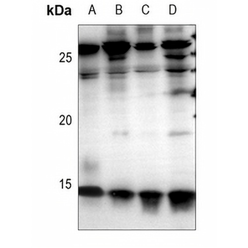 Cystatin C Rabbit Polyclonal Antibody