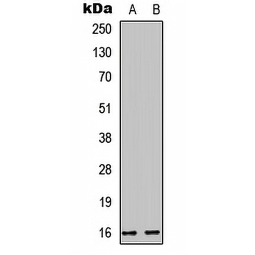 Cystatin E/M Rabbit Polyclonal Antibody