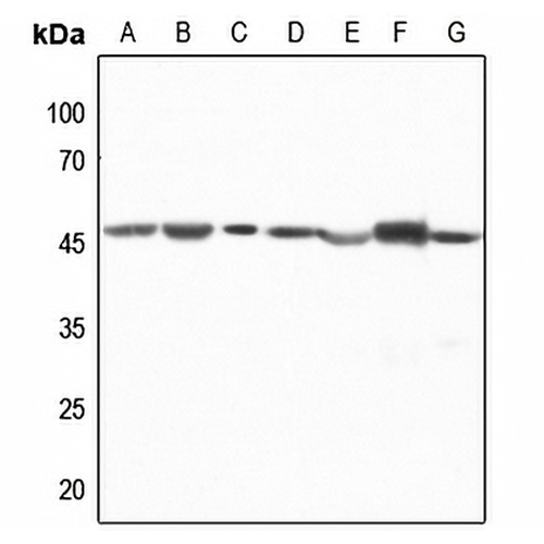 CTBP1 Rabbit Polyclonal Antibody