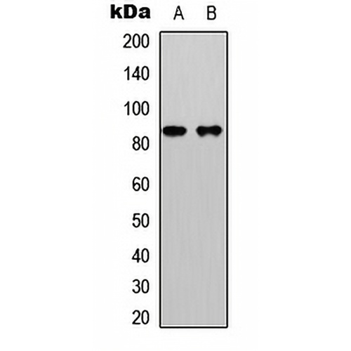 Beta-catenin (Phospho-S33) Rabbit Polyclonal Antibody