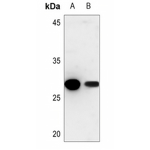 Cathepsin Z Rabbit Polyclonal Antibody