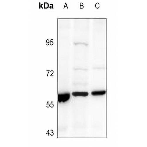 Cytochrome P450 21A2 Rabbit Polyclonal Antibody