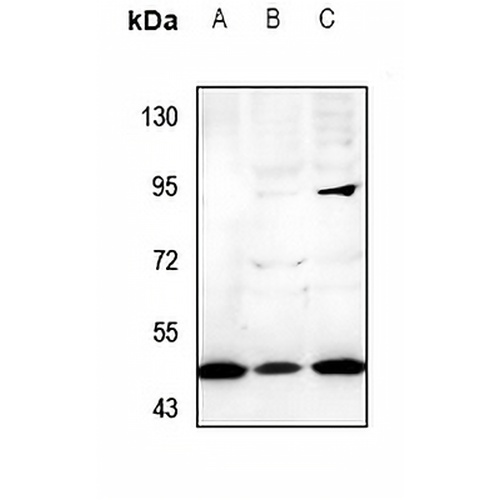 Cytochrome P450 21A2 Rabbit Polyclonal Antibody