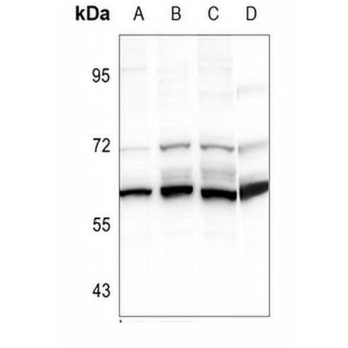 Cytochrome P450 2S1 Rabbit Polyclonal Antibody