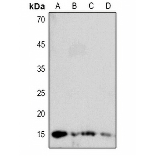 DBI Rabbit Polyclonal Antibody
