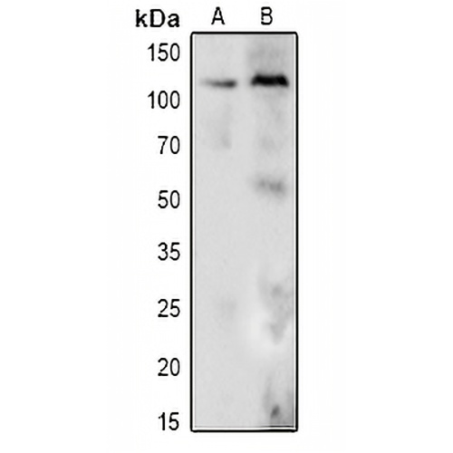 DDX24 Rabbit Polyclonal Antibody