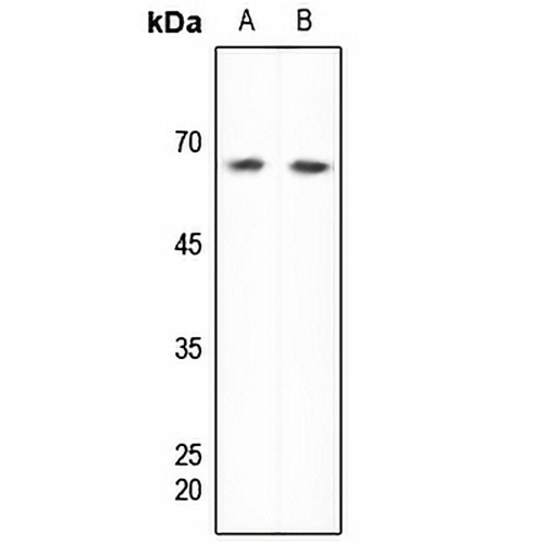 DDX5 Rabbit Polyclonal Antibody