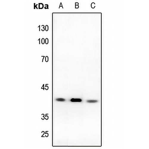 DFF40 Rabbit Polyclonal Antibody