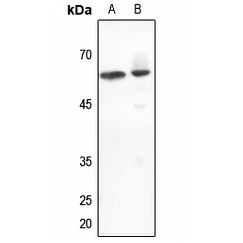 DGK epsilon Rabbit Polyclonal Antibody