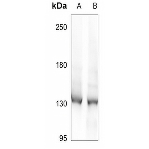 DDX8 Rabbit Polyclonal Antibody