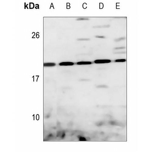 DUSP22 Rabbit Polyclonal Antibody