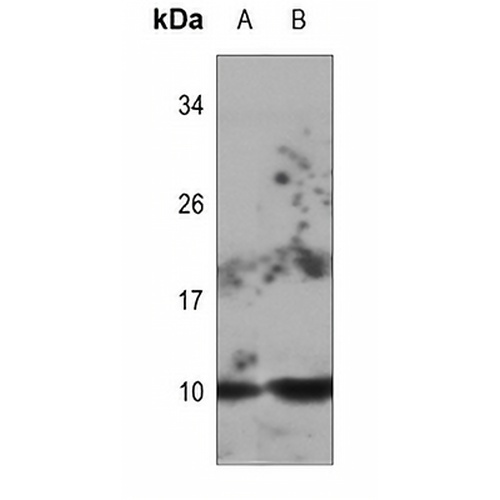 DYNLL2 Rabbit Polyclonal Antibody
