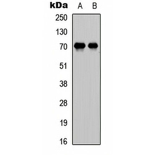 E2F1 Rabbit Polyclonal Antibody