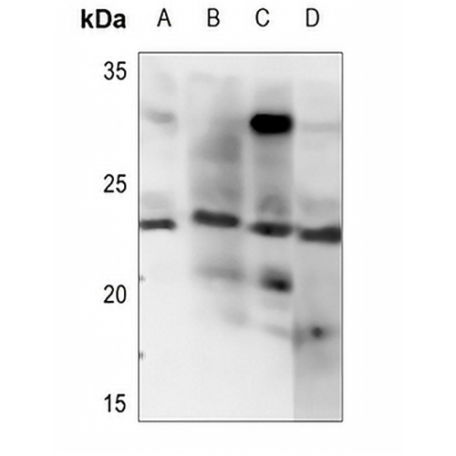 Endothelin 1 Rabbit Polyclonal Antibody