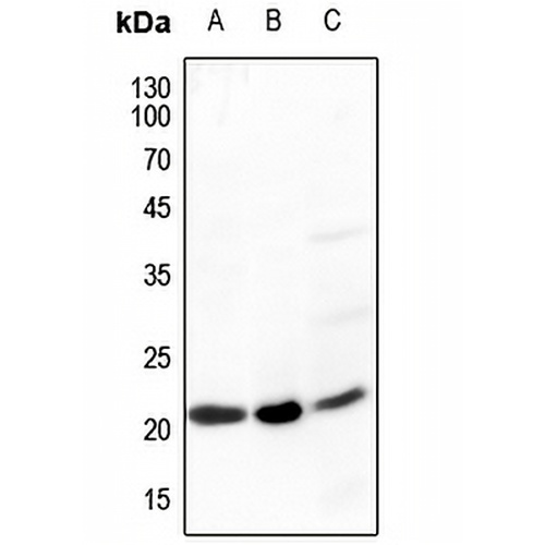 Ephrin A5 Rabbit Polyclonal Antibody