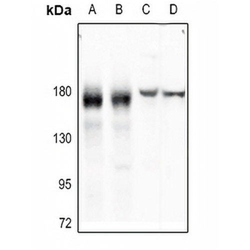 EGFR Rabbit Polyclonal Antibody