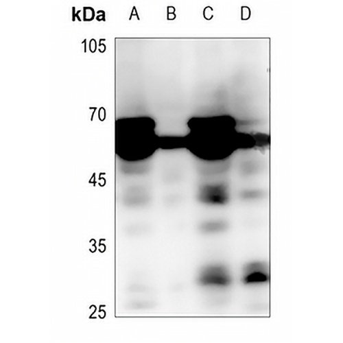 MEN Rabbit Polyclonal Antibody