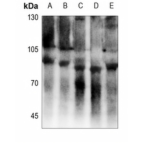 EMR2 Rabbit Polyclonal Antibody