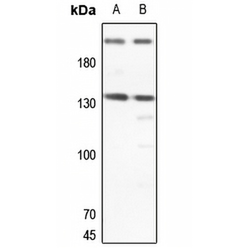ERCC5 Rabbit Polyclonal Antibody