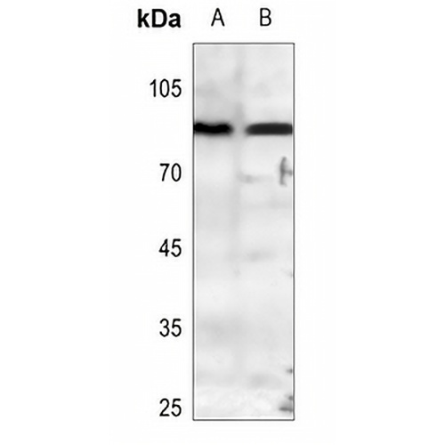 PE2 Rabbit Polyclonal Antibody