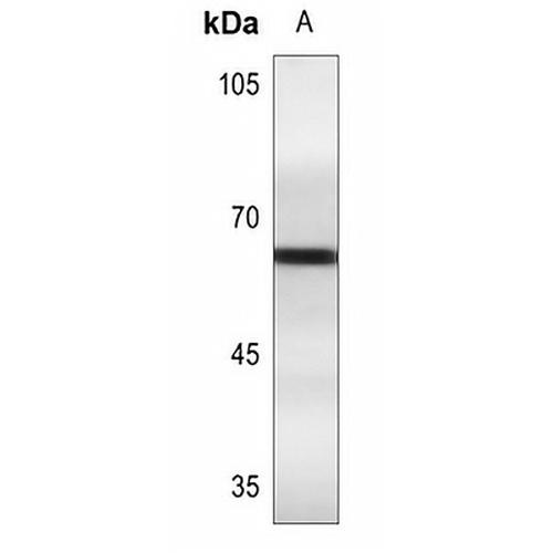 Estrogen Receptor alpha (Phospho-S106) Rabbit Polyclonal Antibody