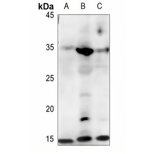 FABP4 Rabbit Polyclonal Antibody