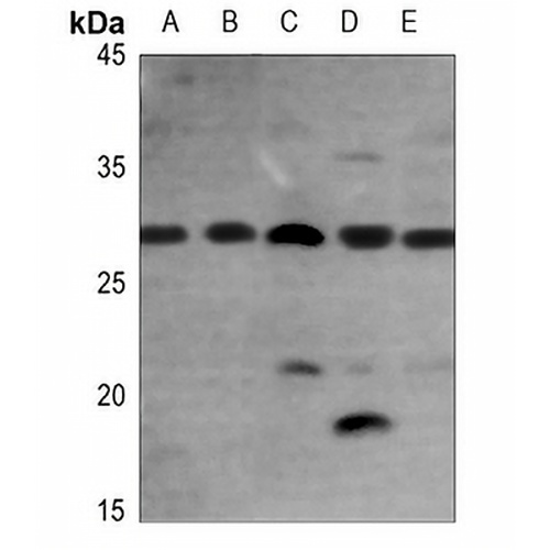 FGF23 Rabbit Polyclonal Antibody