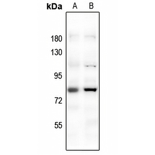 FOXO1 Rabbit Polyclonal Antibody