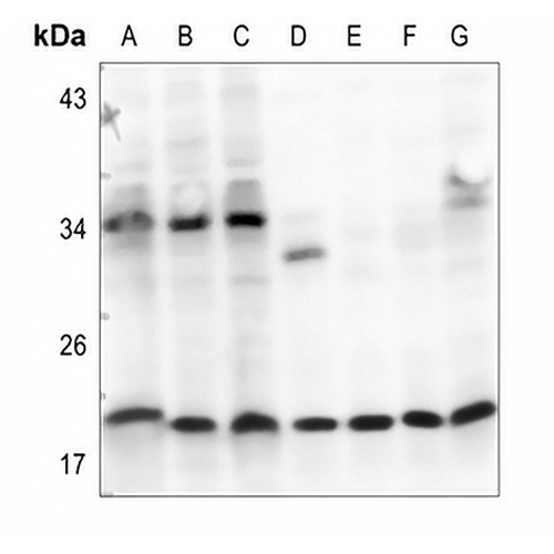 FSH beta Rabbit Polyclonal Antibody