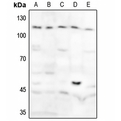 GAB1 (Phospho-Y627) Rabbit Polyclonal Antibody