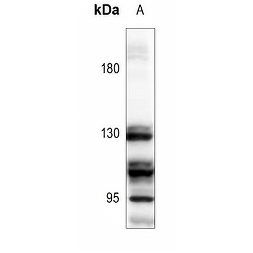 GABBR1 Rabbit Polyclonal Antibody