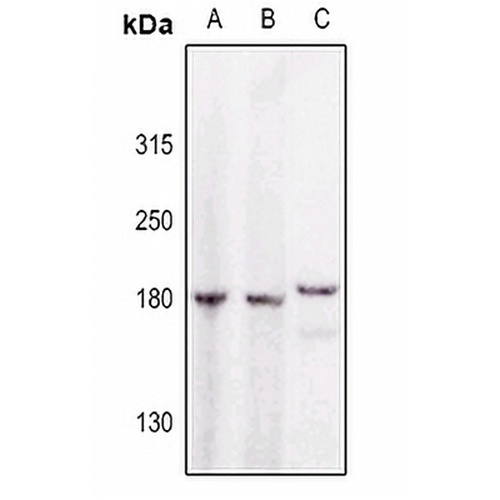 GAK Rabbit Polyclonal Antibody