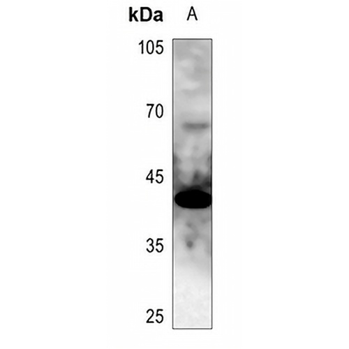 GATA1 Rabbit Polyclonal Antibody