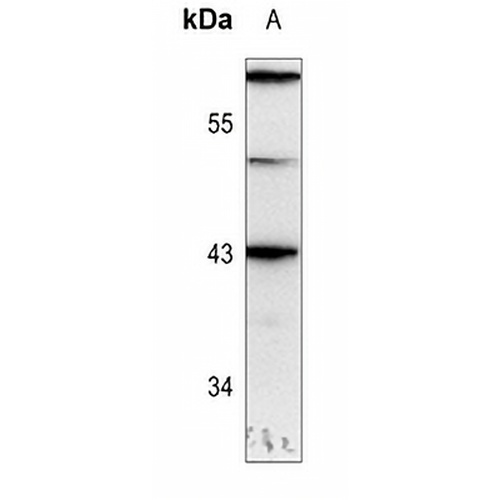 GATA1 (Phospho-S310) Rabbit Polyclonal Antibody