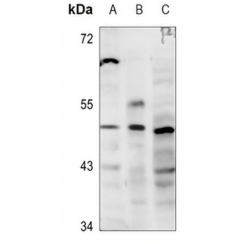 GATA3 Rabbit Polyclonal Antibody