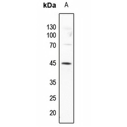 GATA3 (Phospho-S308) Rabbit Polyclonal Antibody