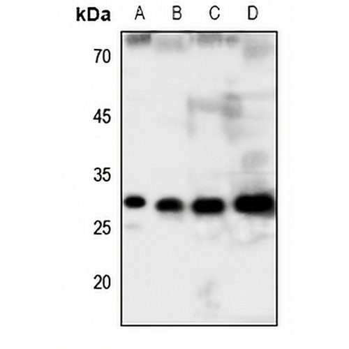 GCLM Rabbit Polyclonal Antibody