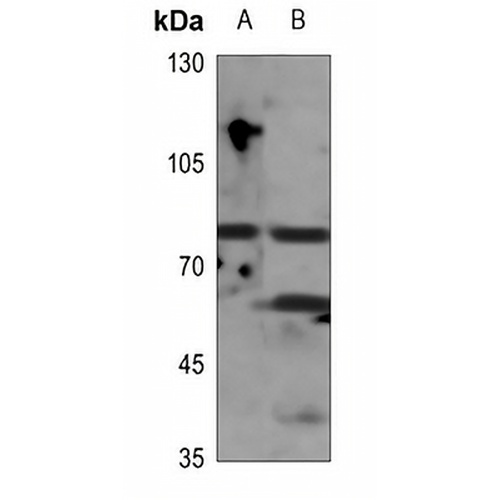 GIT2 Rabbit Polyclonal Antibody