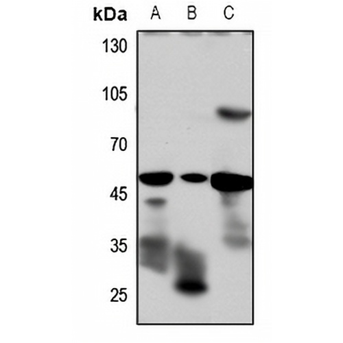 GLP-1 Receptor Rabbit Polyclonal Antibody