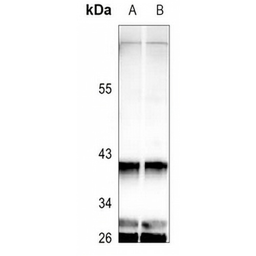 GNAT1 Rabbit Polyclonal Antibody
