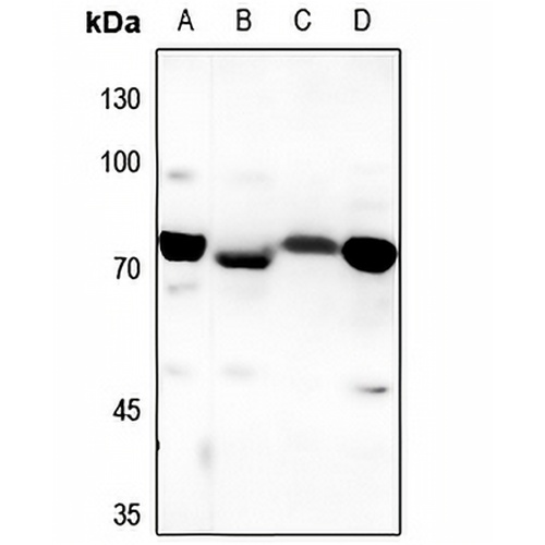 DHAPAT Rabbit Polyclonal Antibody
