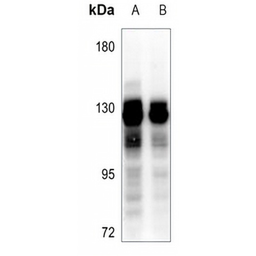 GPRIN1 Rabbit Polyclonal Antibody