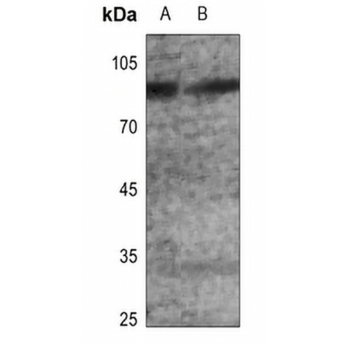GLUR2 (Phospho-S880) Rabbit Polyclonal Antibody