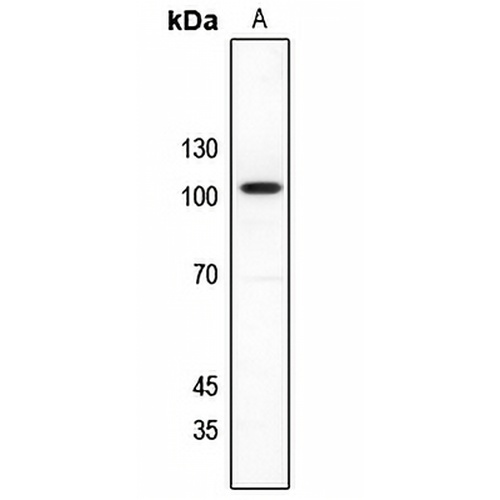 NMDAR1 Rabbit Polyclonal Antibody