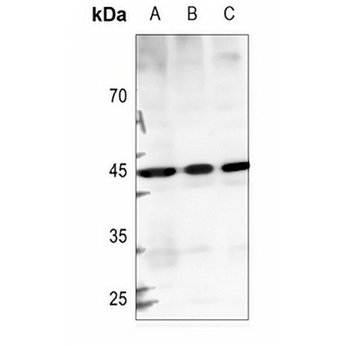 GTPBP5 Rabbit Polyclonal Antibody