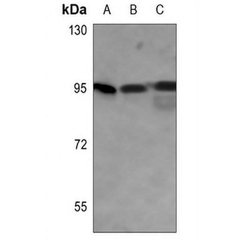 GYS1 (Phospho-S645) Rabbit Polyclonal Antibody