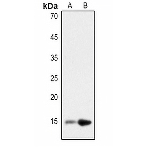 Histone H2B (Acetyl-K12) Rabbit Polyclonal Antibody