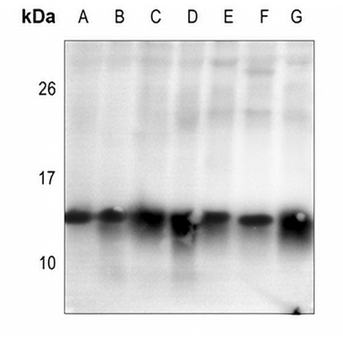 Histone H2B (Acetyl-K15) Rabbit Polyclonal Antibody